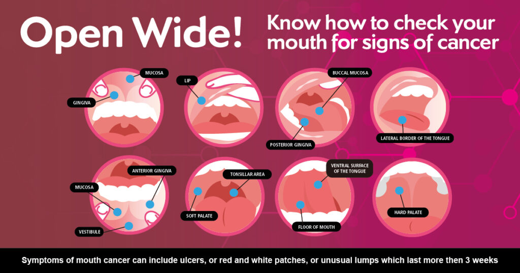 Mouth Cancer Self Check